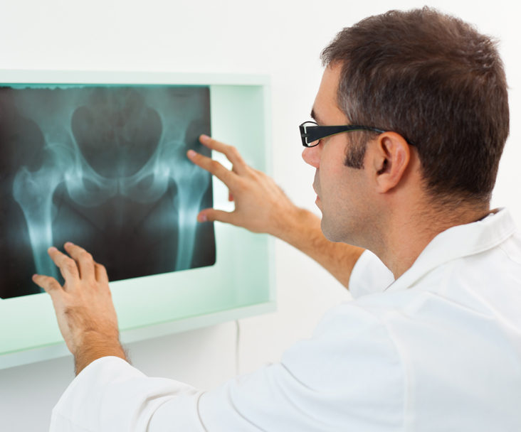 What to Look for When Choosing a Hip Specialist